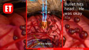 Bullet hits head... He was okay