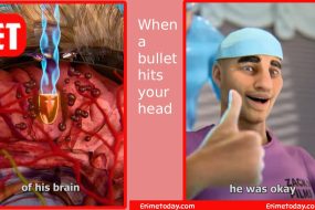 When a bullet hits your head