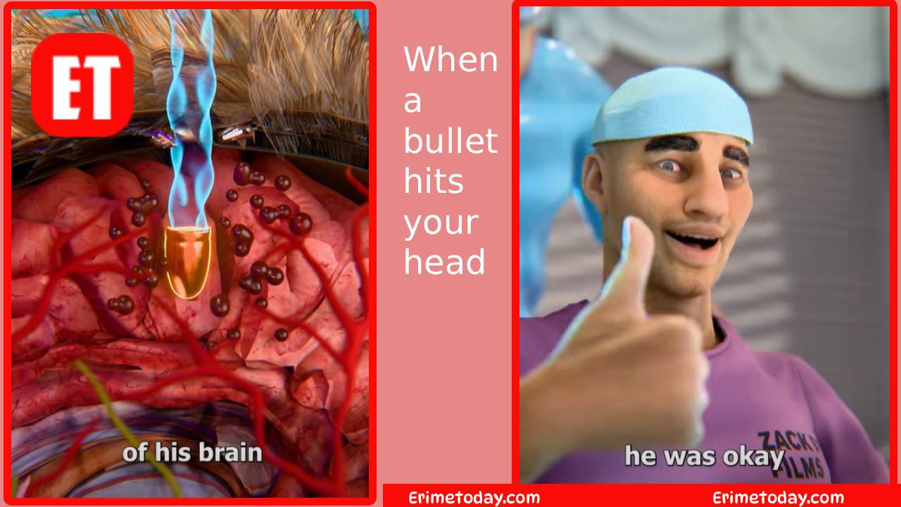 When a bullet hits your head